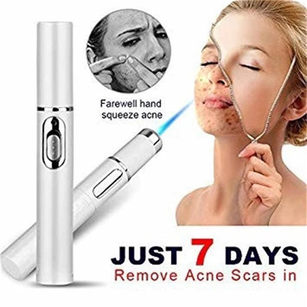 Blue Light Acne Treatment Pen – Skin Repair Device for Acne, Scars & Wrinkles