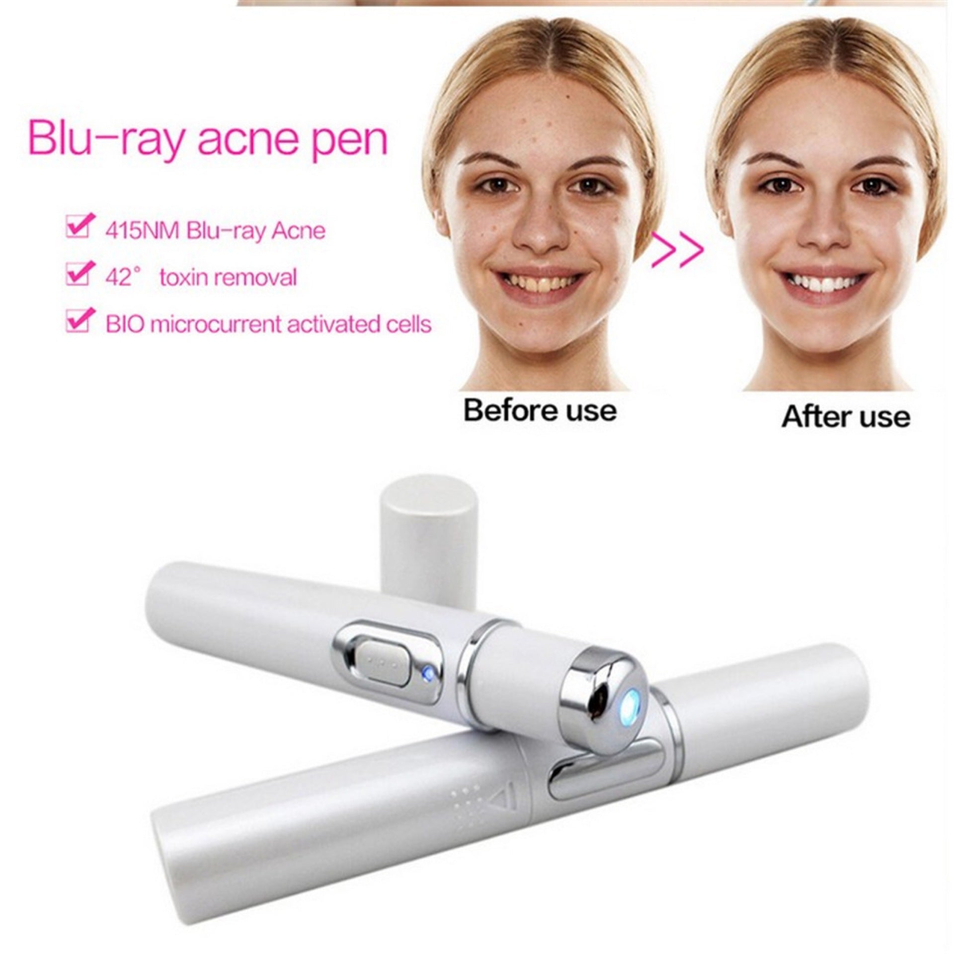 Blue Light Acne Treatment Pen – Skin Repair Device for Acne, Scars & Wrinkles