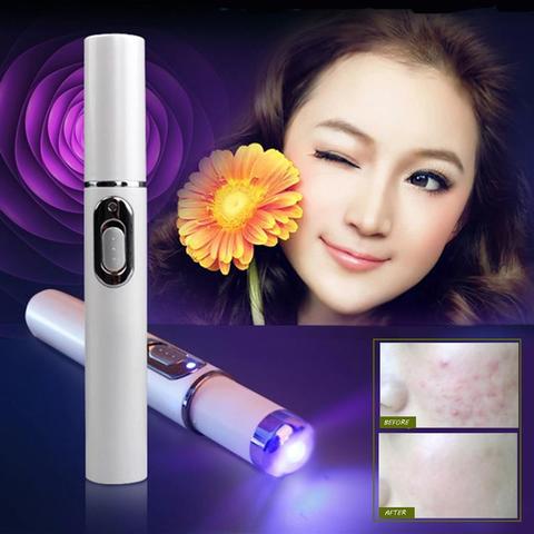 Blue Light Acne Treatment Pen – Skin Repair Device for Acne, Scars & Wrinkles
