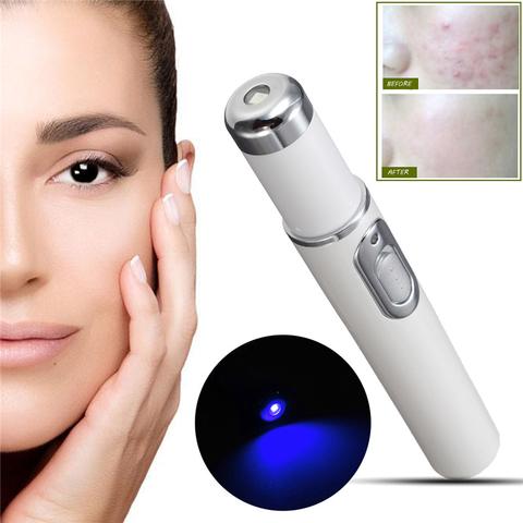 Blue Light Acne Treatment Pen – Skin Repair Device for Acne, Scars & Wrinkles